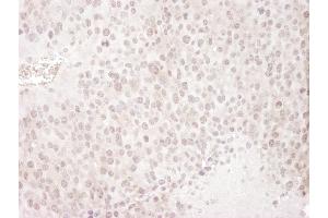 anti-Gem (Nuclear Organelle) Associated Protein 4 (GEMIN4) (C-Term) antibody