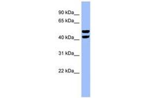 Image no. 1 for anti-6-phosphofructo-2-Kinase/fructose-2,6-Biphosphatase 4 (PFKFB4) (N-Term) antibody (ABIN6741800) (PFKFB4 antibody  (N-Term))