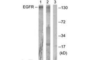 Western blot analysis of extracts from HuvEc cells, treated with Serum 20% 30', using EGFR (Ab-1016) Antibody. (EGFR antibody  (AA 986-1035))