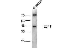 Mouse skeleton lysates probed with E2F1 Polyclonal Antibody, Unconjugated  at 1:300 dilution and 4˚C overnight incubation.