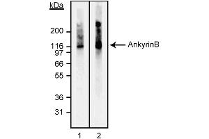 Western blot analysis of Ankyrin B. (ANK2 antibody)