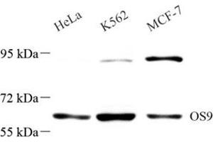 Western blot analysis of OS9 (ABIN7074957) at dilution of 1: 1000 (OS9 antibody)