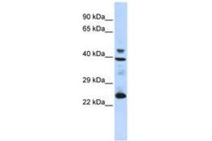 Image no. 1 for anti-Selenoprotein P (SEPP1) (AA 35-84) antibody (ABIN6743265) (Selenoprotein P antibody  (AA 35-84))