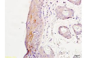 Formalin-fixed and paraffin embedded rat skin labeled with Rabbit Anti NR2A/NMDAR2A Polyclonal Antibody, Unconjugated (ABIN747353) at 1:200 followed by conjugation to the secondary antibody and DAB staining (NMDAR2A antibody  (AA 851-950))