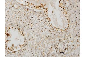 Immunoperoxidase of monoclonal antibody to KLHDC4 on formalin-fixed paraffin-embedded human prostate. (KLHDC4 antibody  (AA 1-463))
