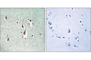 Immunohistochemistry (IHC) image for anti-Cyclin D1 (CCND1) (AA 246-295) antibody (ABIN2888623) (Cyclin D1 antibody  (AA 246-295))