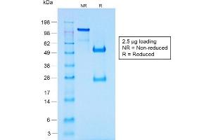 SDS-PAGE Analysis of Purified CHGA Rabbit Recombinant Monoclonal Antibody ABIN6383805.