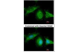 ICC/IF Image Immunofluorescence analysis of methanol-fixed HeLa, using HSC70, antibody at 1:200 dilution. (Hsc70 antibody  (C-Term))