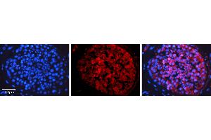 Rabbit Anti-HDAC4 Antibody   Formalin Fixed Paraffin Embedded Tissue: Human Testis Tissue Observed Staining: Cytoplasm Primary Antibody Concentration: 1:100 Other Working Concentrations: N/A Secondary Antibody: Donkey anti-Rabbit-Cy3 Secondary Antibody Concentration: 1:200 Magnification: 20X Exposure Time: 0. (HDAC4 antibody  (N-Term))