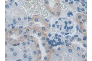 Immunohistochemistry (IHC) image for anti-Tumor Necrosis Factor Receptor Superfamily, Member 11a, NFKB Activator (TNFRSF11A) (AA 359-542) antibody (ABIN7439945)