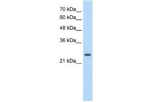 WB Suggested Anti-TSHR Antibody Titration:  0.