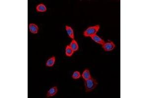 Immunofluorescent analysis of GPR126 staining in LOVO cells. (G Protein-Coupled Receptor 126 antibody)