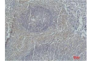 Immunohistochemistry (IHC) image for anti-Caspase 3 (CASP3) antibody (ABIN3188045)