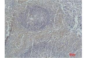 Immunohistochemistry (IHC) analysis of paraffin-embedded Human Tonsil Tissue using Active Caspase-3 Monoclonal Antibody. (Caspase 3 antibody)