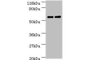 Western blot All lanes: Ces1c antibody at 2 μg/mL Lane 1: Mouse liver tissue Lane 2: Rat liver tissue Secondary Goat polyclonal to rabbit IgG at 1/10000 dilution Predicted band size: 62 kDa Observed band size: 62 kDa (CES1C antibody  (AA 19-550))