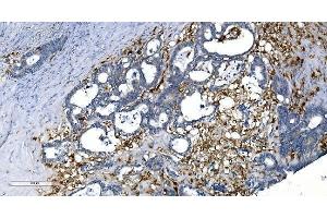 IHC analysis of GCHFR using anti-GCHFR antibody (ABIN7600511). (GCHFR antibody  (AA 2-84))