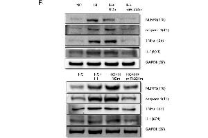 Inhibition of the MALAT1/miR-224-5p/NLRP3 axis reduced inflammation caused by exposure to IH and HG. (NLRP3 antibody)