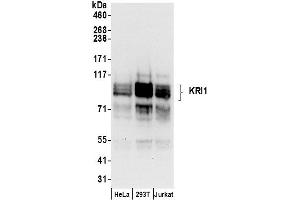 Western Blotting (WB) image for anti-KRI1 Homolog (KRI1) (AA 200-250) antibody (ABIN7450401)