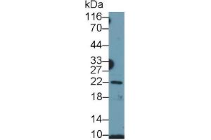 Detection of GH in Human Placenta lysate using Polyclonal Antibody to Growth Hormone (GH) (Growth Hormone 1 antibody  (AA 28-217))