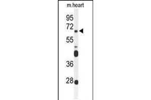 Western blot analysis of FZD4 Antibody in mouse heart tissue lysates (35ug/lane) (FZD4 antibody  (C-Term))