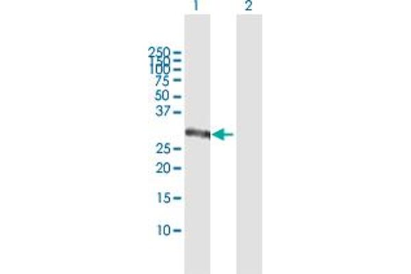 CSGALNACT1 anticorps  (AA 1-297)