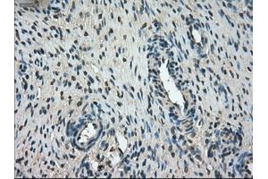 Immunohistochemical staining of paraffin-embedded Ovary tissue using anti-FERMT2mouse monoclonal antibody.