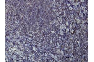 Immunoperoxidase of monoclonal antibody to EPHB3 on formalin-fixed paraffin-embedded human tonsil. (EPH Receptor B3 antibody  (AA 899-997))