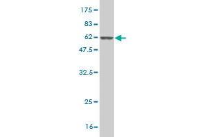 Western Blot detection against Immunogen (55. (NQO1 antibody  (AA 1-274))