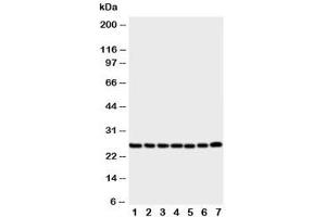 Western blot testing of SIP antibody and Lane 1:  rat liver (CACYBP antibody  (Middle Region))