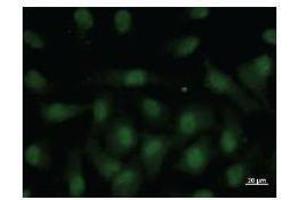 Immunostaining analysis in HeLa cells. (NR4A1 antibody)