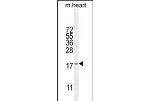 SNR27 Antibody (Center) (ABIN655835 and ABIN2845250) western blot analysis in mouse heart tissue lysates (35 μg/lane). (SNRNP27 antibody  (AA 69-98))