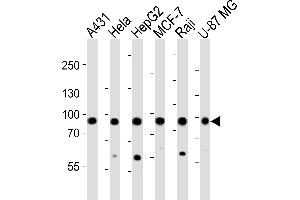 Western blot analysis of lysates from A431, Hela, HepG2, MCF-7, Raji, U-87 MG cell line (from left to right), using IT Antibody (Center) (ABIN6242975 and ABIN6577493). (IMMT antibody  (AA 170-203))