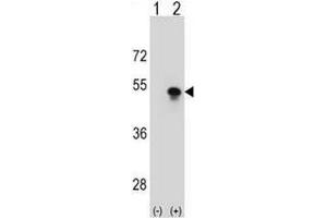 Western blot analysis of SNAPC1 (arrow) using rabbit polyclonal SNAPC1 Antibody (Center) .