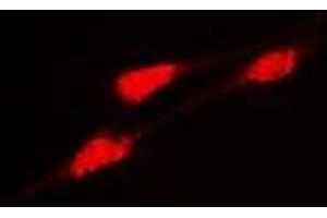 Immunofluorescent analysis of DLGAP5 staining in Hela cells.