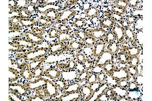 Formalin-fixed and paraffin embedded rat kidney tissue labeled with Anti-Claudin 5 Polyclonal Antibody, Unconjugated (ABIN673869) followed by conjugation to the secondary antibody and DAB staining (Claudin 5 antibody)