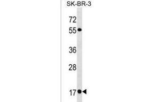 RAB19 Antibody (N-term) (ABIN1538880 and ABIN2850090) western blot analysis in SK-BR-3 cell line lysates (35 μg/lane). (RAB19 antibody  (N-Term))