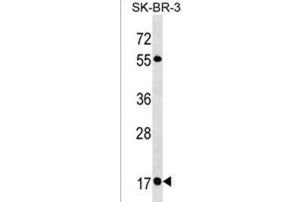 RAB19 Antikörper  (N-Term)
