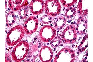 IHC Information: Paraffin embedded renaltubules tissue, tested with an antibody dilution of 5 ug/ml. (T-Box 18 antibody  (C-Term))