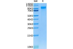 Human E-selectin on Tris-Bis PAGE under reduced condition. (Selectin E/CD62e Protein (AA 22-556) (His-Avi Tag))