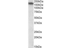 Image no. 1 for anti-Neurofilament Triplet M Protein (NEFM) (Internal Region) antibody (ABIN453988) (NEFM antibody  (Internal Region))