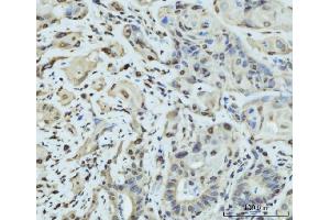 IHC analysis of SCP3/SYCP3 using anti-SCP3/SYCP3 antibody (ABIN7602415).