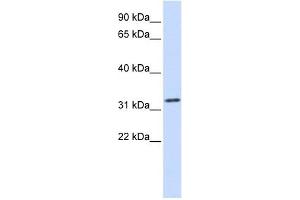Tropomyosin 1 antibody used at 1 ug/ml to detect target protein. (Tropomyosin antibody)