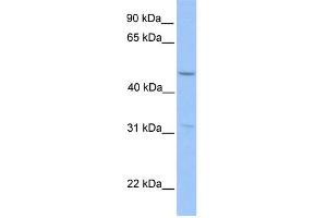 WB Suggested Anti-ZNF342 Antibody Titration:  0. (Zinc Finger Protein 296 (ZNF296) (Middle Region) antibody)