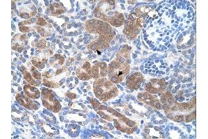 CD36 antibody was used for immunohistochemistry at a concentration of 4-8 ug/ml. (CD36 antibody)