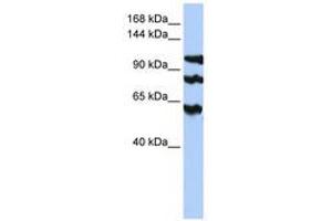 Image no. 1 for anti-Protein Phosphatase 1, Regulatory Subunit 13B (PPP1R13B) (AA 900-949) antibody (ABIN6741009) (PPP1R13B antibody  (AA 900-949))