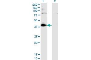 Western Blot analysis of DHDH expression in transfected 293T cell line by DHDH monoclonal antibody (M03), clone 3A11. (DHDH antibody  (AA 235-334))
