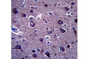Anti-APP antibody immunohistochemistry analysis in formalin fixed and paraffin embedded human brain tissue. (APP antibody  (AA 333-362))