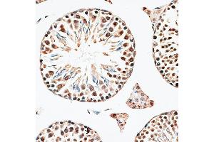 Immunohistochemistry (IHC) image for anti-Chromobox Homolog 6 (CBX6) (AA 80-180) antibody (ABIN6138026)