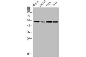 Western blot analysis of HepG2 JK Colo Hela using TRMT11 antibody. (Trmt11 antibody  (C-Term))