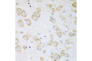 Immunohistochemistry of paraffin-embedded mouse brain using ACOX1 antibody at dilution of 1:100 (40x lens). (ACOX1 antibody)